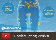 coolsculpting video thumbnail--in-office video